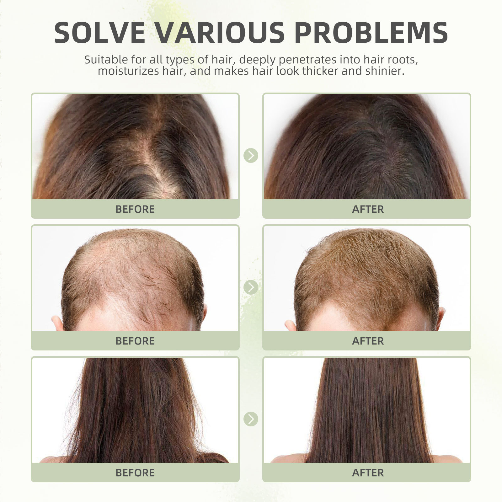 huile de ricin Eelhoe pour réparer les dommages, nourrir, lisser et éclaircir la capsule de soin capillaire dense_voghion.com