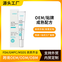 �|�ρ�����OEM������ӡ��˪��ӱ�����˪Acne Treatment Cream