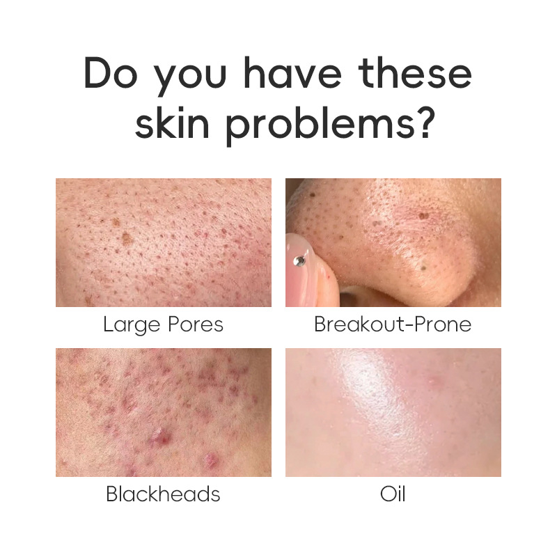 Cross-Border Exclusive Facial Oil Control & Acne-Fighting Toner with 2% Salicylic Acid - Blackhead Removal, Exfoliating & Pore-Minimizing Essence