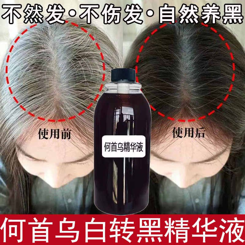 何首烏白転黒精華液白髪転黒髪栄養液滋養毛包養髪保護脱育毛液|undefined