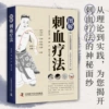 [图解刺血疗法]
