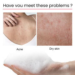 EELHOE Carbon Clay Back Soap, Whitening Body Cleansing Skin, Fading Dark Spots and Acne Scars, Exfoliating, Moisturizing, and Brightening Skin Soap