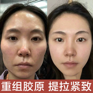 Collagen filling cream to lift the head lines anti-aging filling depressions firming anti-aging restructuring cream high moisturizing cream
