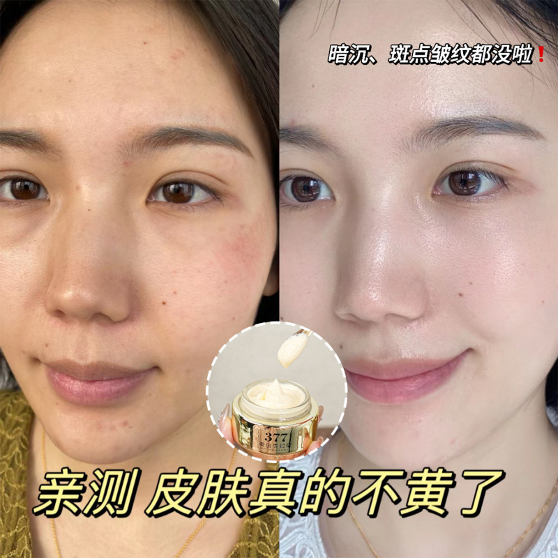 名美人377美白貴婦人クリームシミ・薄斑・ニキビ跡改善くすみ・カバー・きめ細やかな保湿貴婦人クリーム|undefined