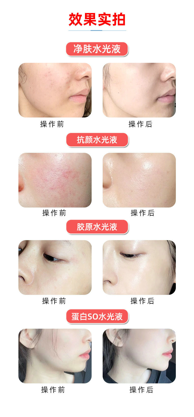 详情3-效果对比5