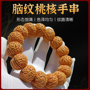 2024�؎XҰ�����y���ҵ��ԭ���Һ��Һ��tƤ��ǈA����������]