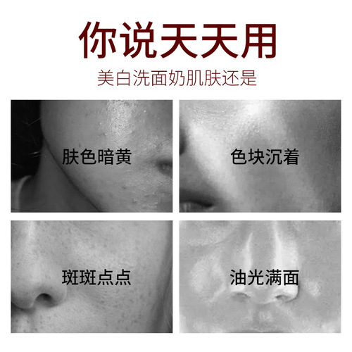 Sendinelle skin whitening freckle removal facial cleanser deep cleansing hydrating moisturizing gentle facial cleanser wholesale