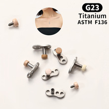 �羳G23ͨ���ѺϽ���ֲ�뼶F136��ɫ������Ƕ�ŷ���ֻ�һ����