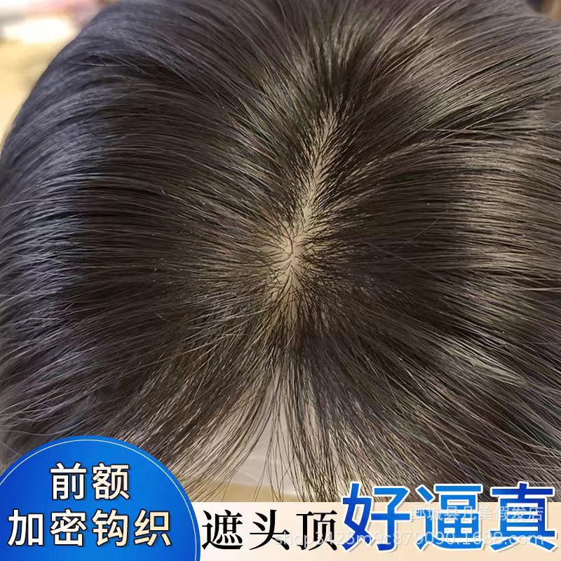 Full hand-woven women's wig piece forehead lanugo delivery needle wig piece real hair increase quantity natural non-trace reissue piece