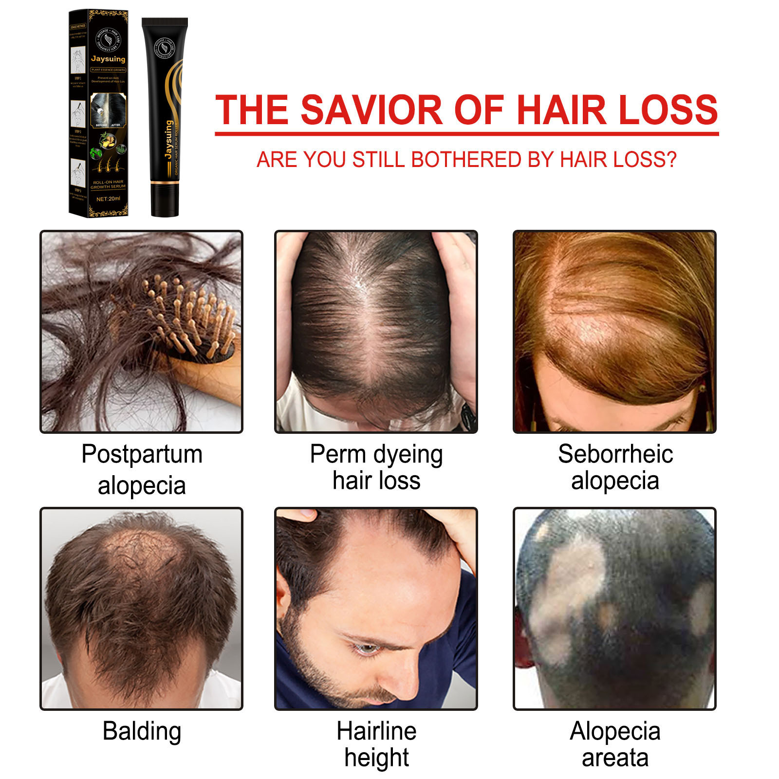 ball massage Jaysuing care solution stimulates scalp, nourishes hair, thickens the hairline, and prevents hair_voghion.com