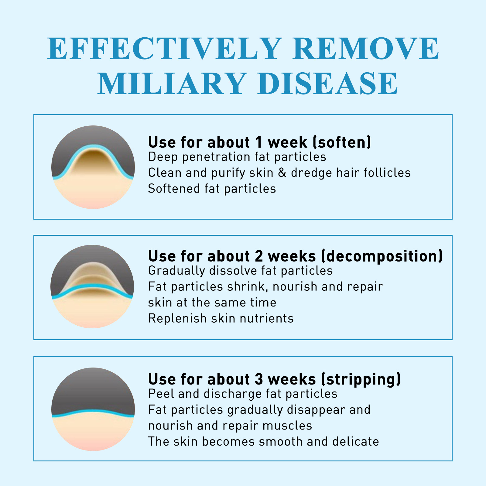 Lõunakuu rasv õligraanulite eemaldamiseks, näo nahaalused massid, tavaline higipiibu graanulite parandav plaaster_voghion.com