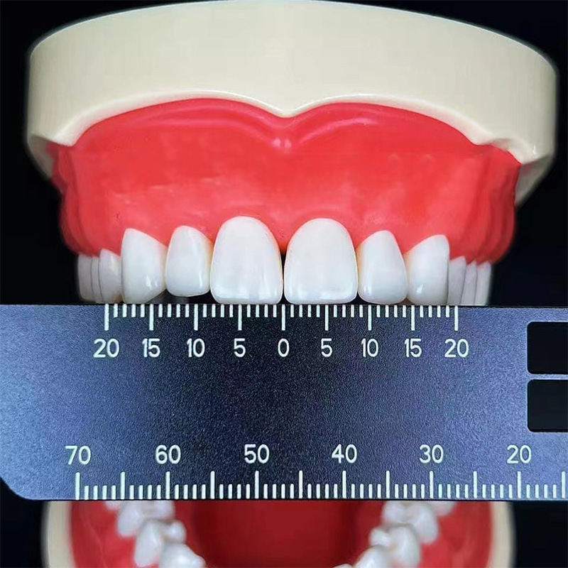 Instrumento dental técnico pinza Escala de doble cara regla de medición vertical espaciado de los dientes Regla de medición tubo de raíz Regla de medición image 3
