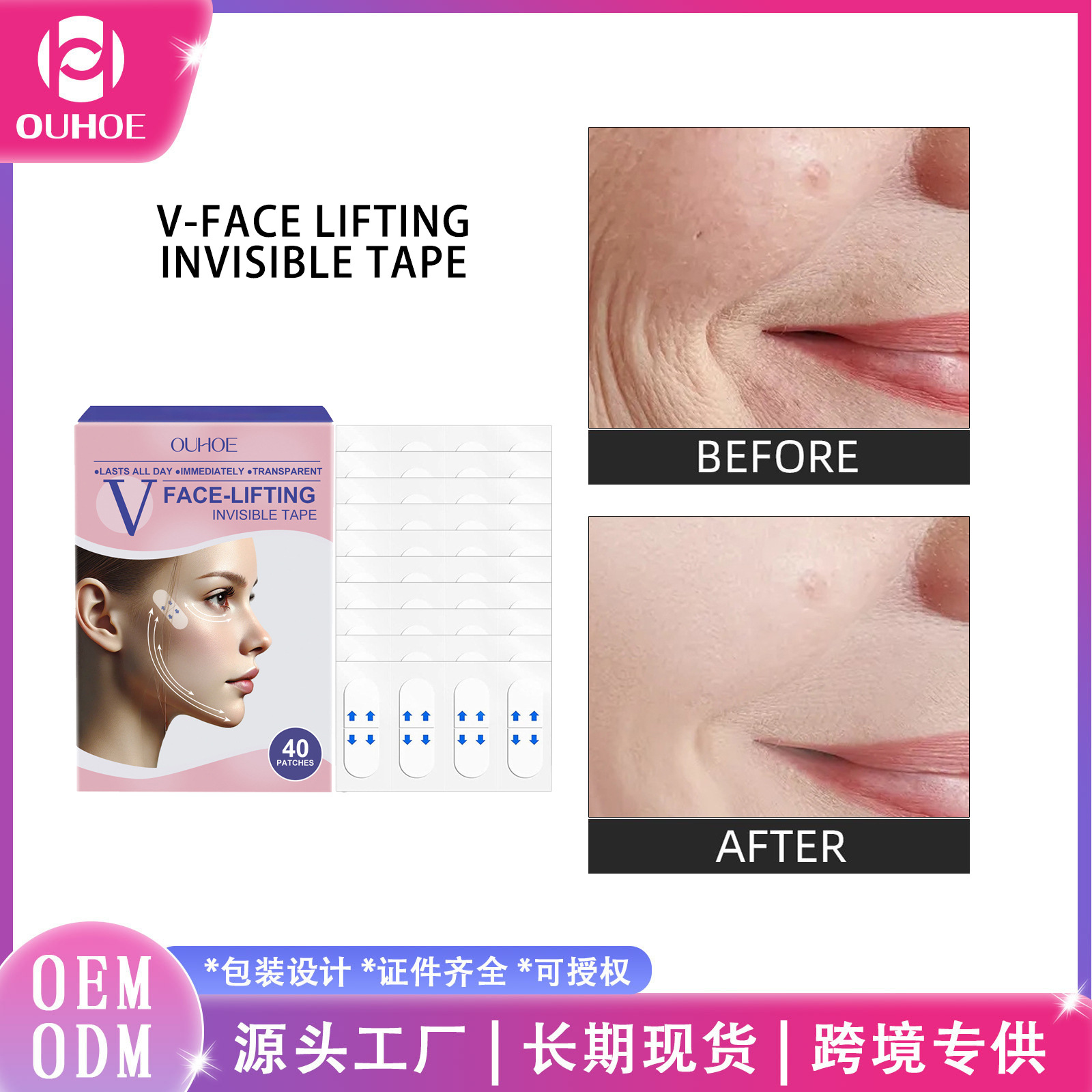 Ouhoe Facial Care Patch, Water-Locking, Softening, Breathable and Comfortable, Suitable for Lifting the Chin Line, Beauty Patch