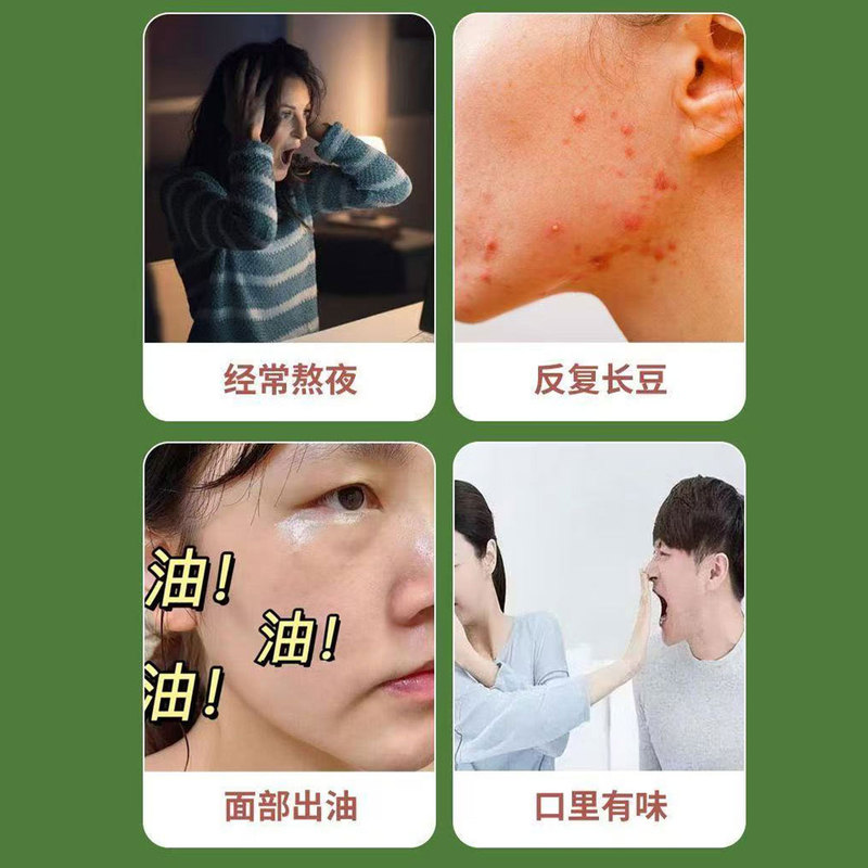 タンポポ、金柑茶、菊、八重バラ、本物の原料、独立した三角袋、卸売ハーブティー|undefined