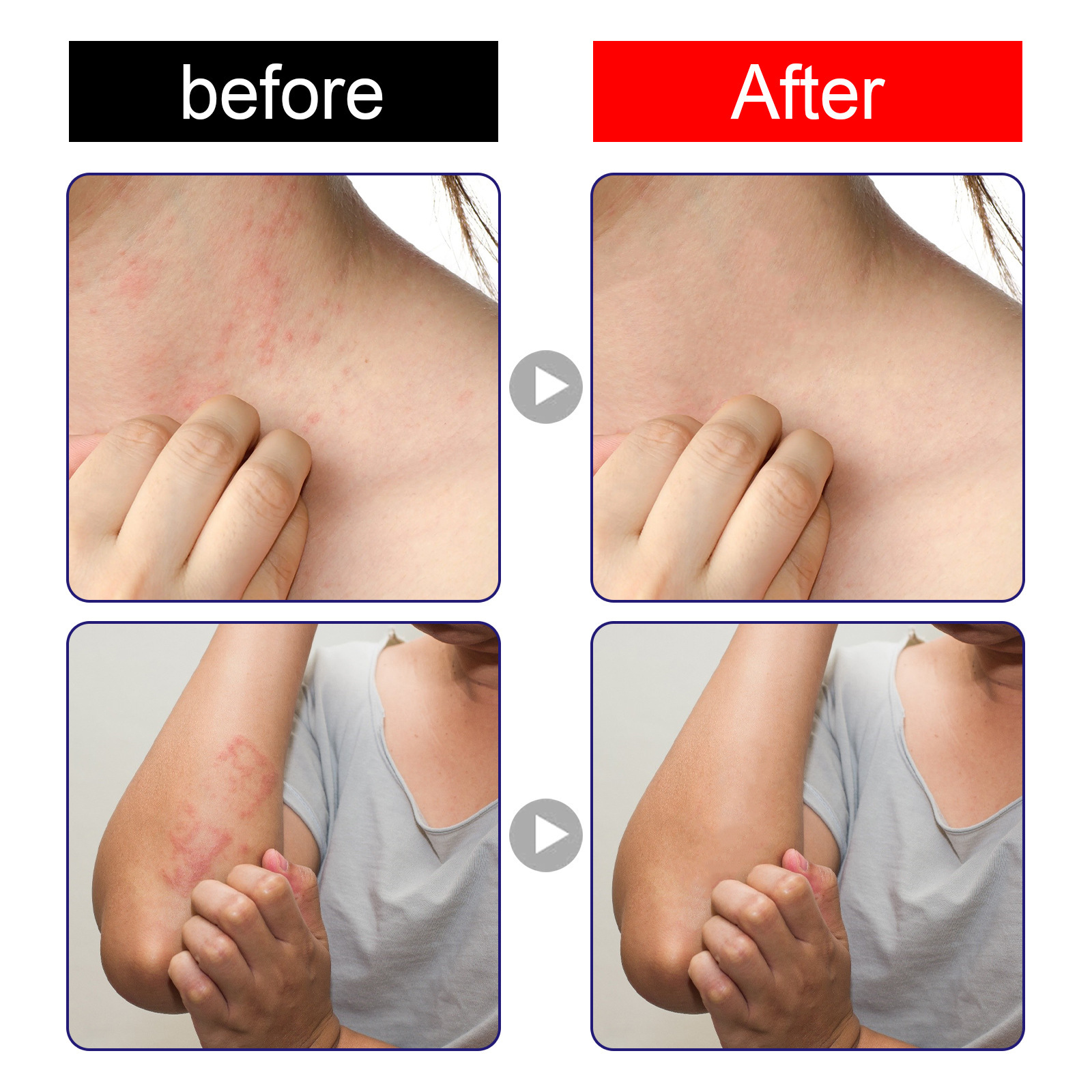 south moon紫花地丁皮膚止癢修護膏