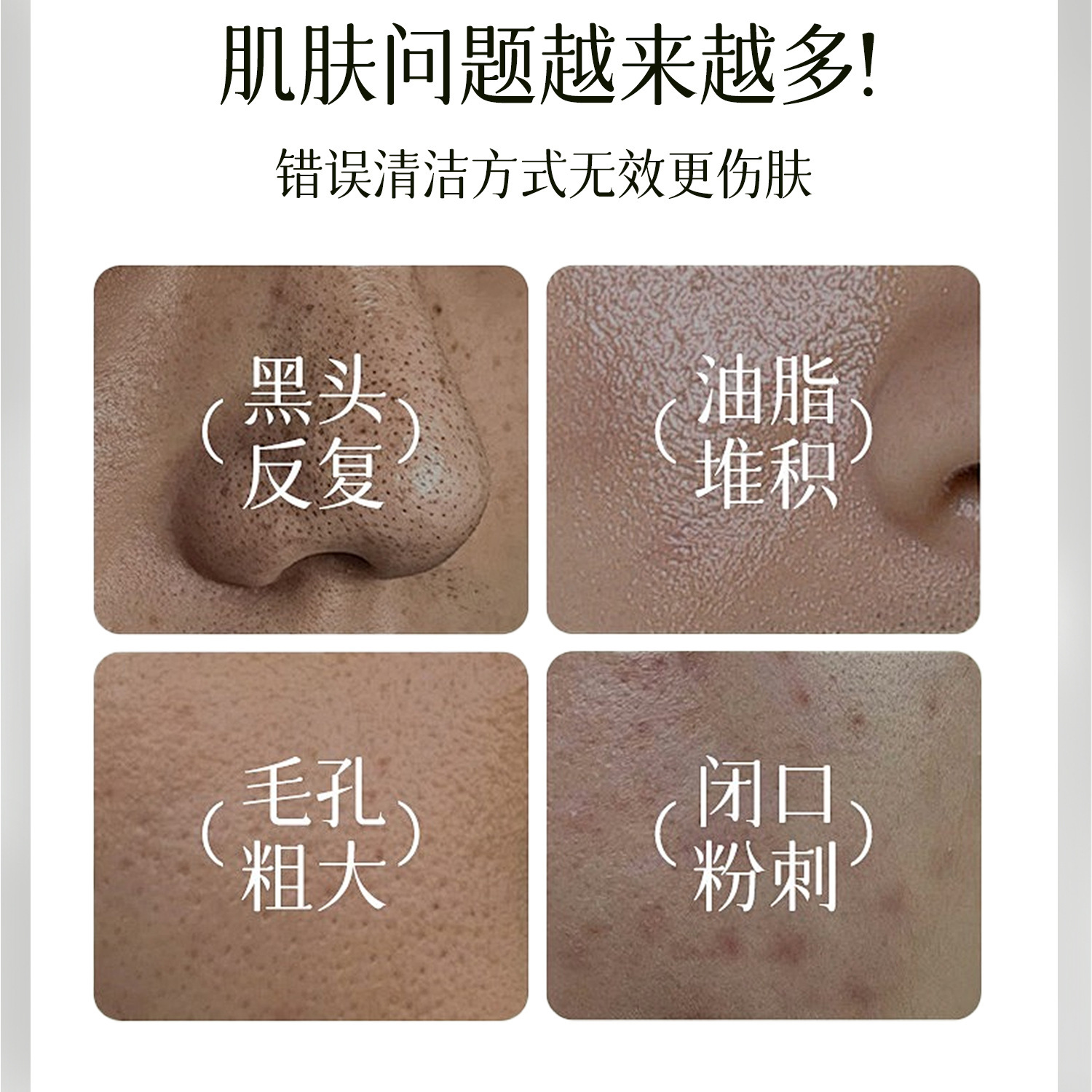 Extracto muscular secreta, limpieza profunda de la membrana nasal para eliminar el acné cerrado, fábrica de agua y aceite image 3