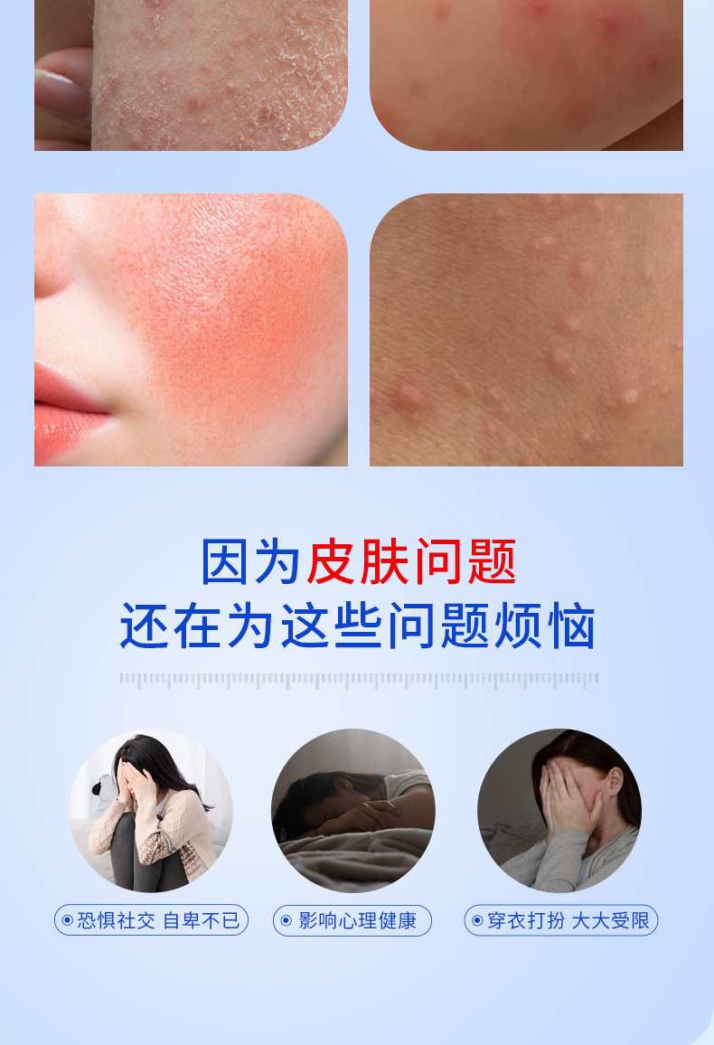 Dermatitis Eczema Gel External Herbal Topical for Itchy Skin and Joint Discomfort 黔械注准20252090184 preparation