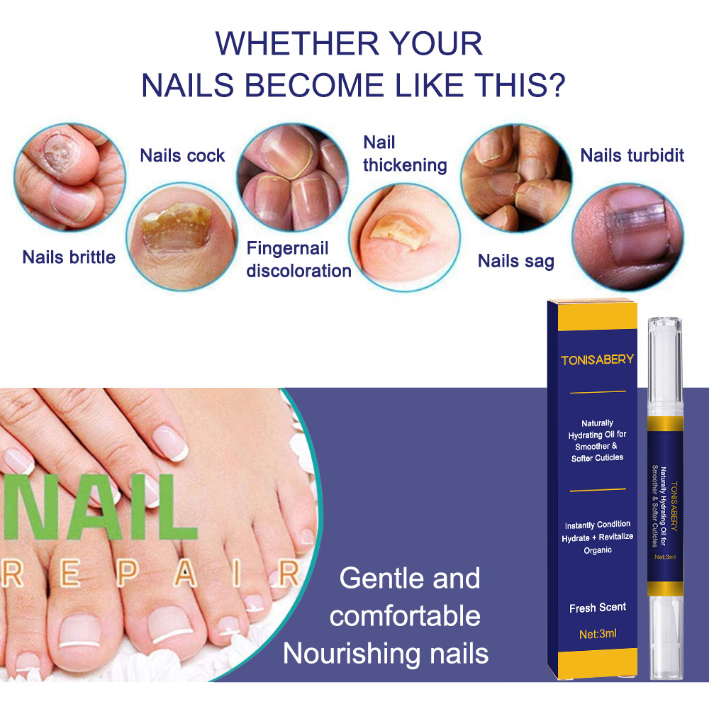 Nagelgro Kräidernagelléisung, One-Strike Hell Reparatur Stéck/Box biologesch Fleegeléisung iwwer_voghion.com