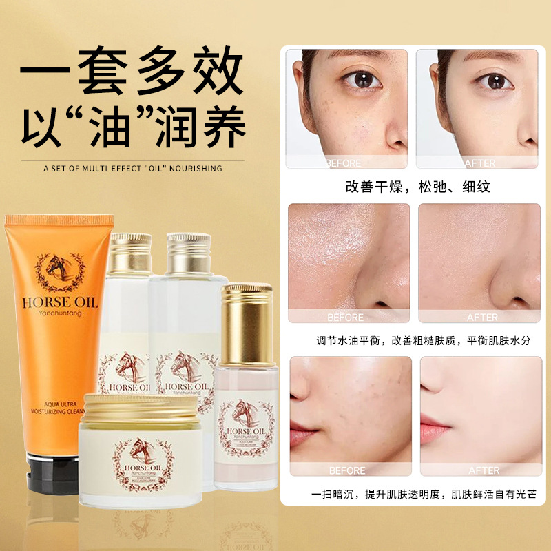 Yunchuntang aceite de caballo hidratante caja de regalo de cinco piezas, hidratación, hidratación y brillo de la piel, caja de cuidado de la piel facial, producto único