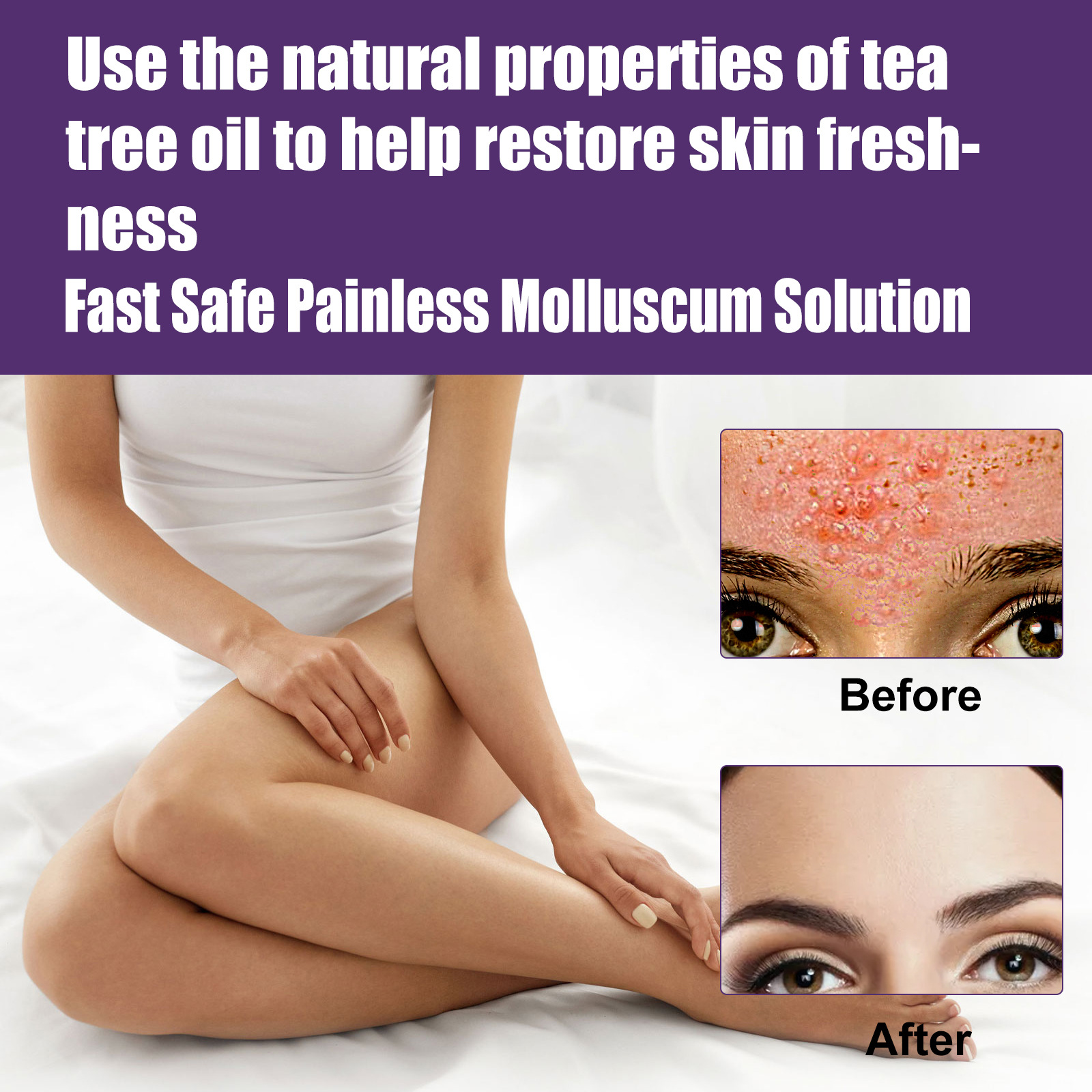 Skin Cleaning Removal of Underarm Hand and Foot Anti Wart Flat Care Liquid Set_voghion.com