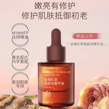 MYMHFPõ��t�辫�ͽ������沿���AҺ�aˮ���AҺ����Һ���w�����l