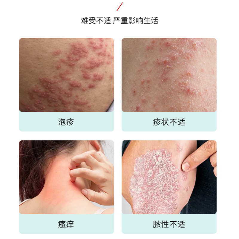 香港李四郎乌蛇止痒膏 舒缓皮肤问题不适皮肤干燥瘙痒外用保健膏|undefined