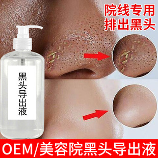 Blackhead outlet beauty salon deep cleansing shrink pores mild small bubble closed blackhead acne outlet