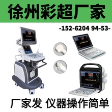 国产彩超机器 彩超机器图片/价格 彩超 B超机生产厂家-新玛758