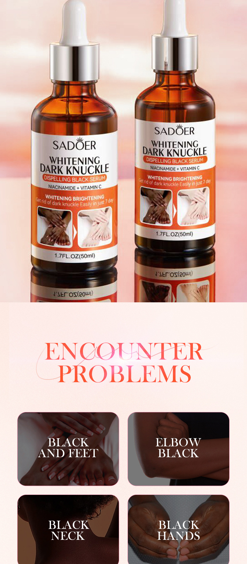 SADOER Alle Englisch Joint Whitening & Blackning Körper Whitening Allgemeine essenz_voghion.com