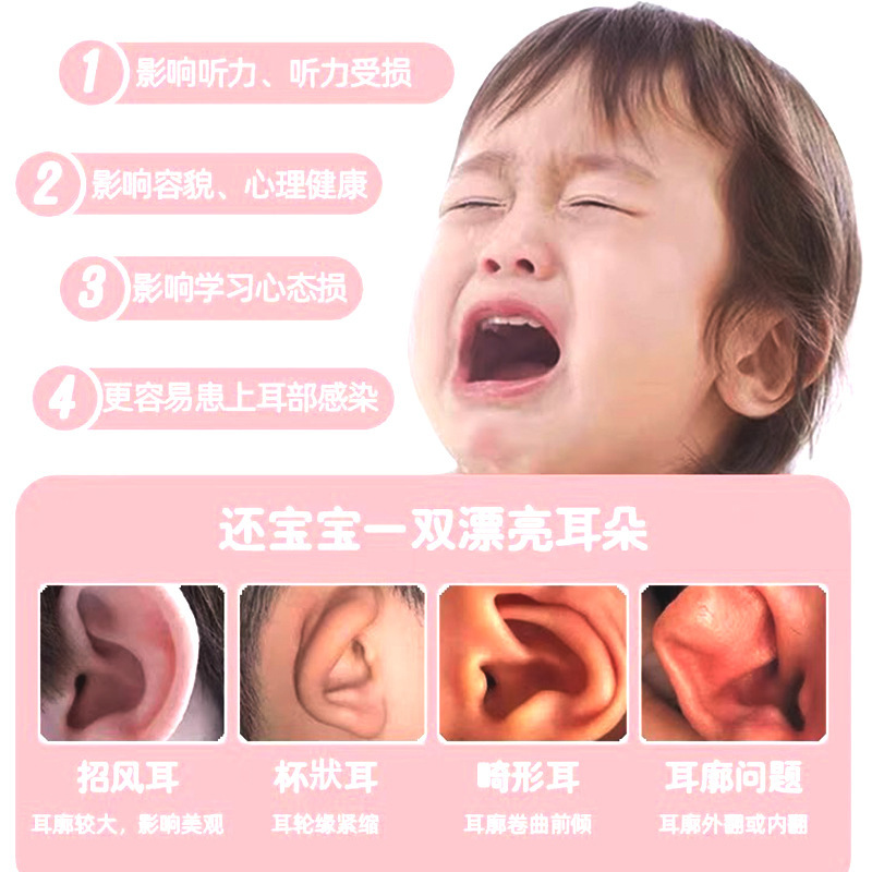 赤ちゃんの耳介、子供の風邪耳矯正、赤ちゃんのシリコン耳アーティファクト、柔軟な素材の成形|undefined
