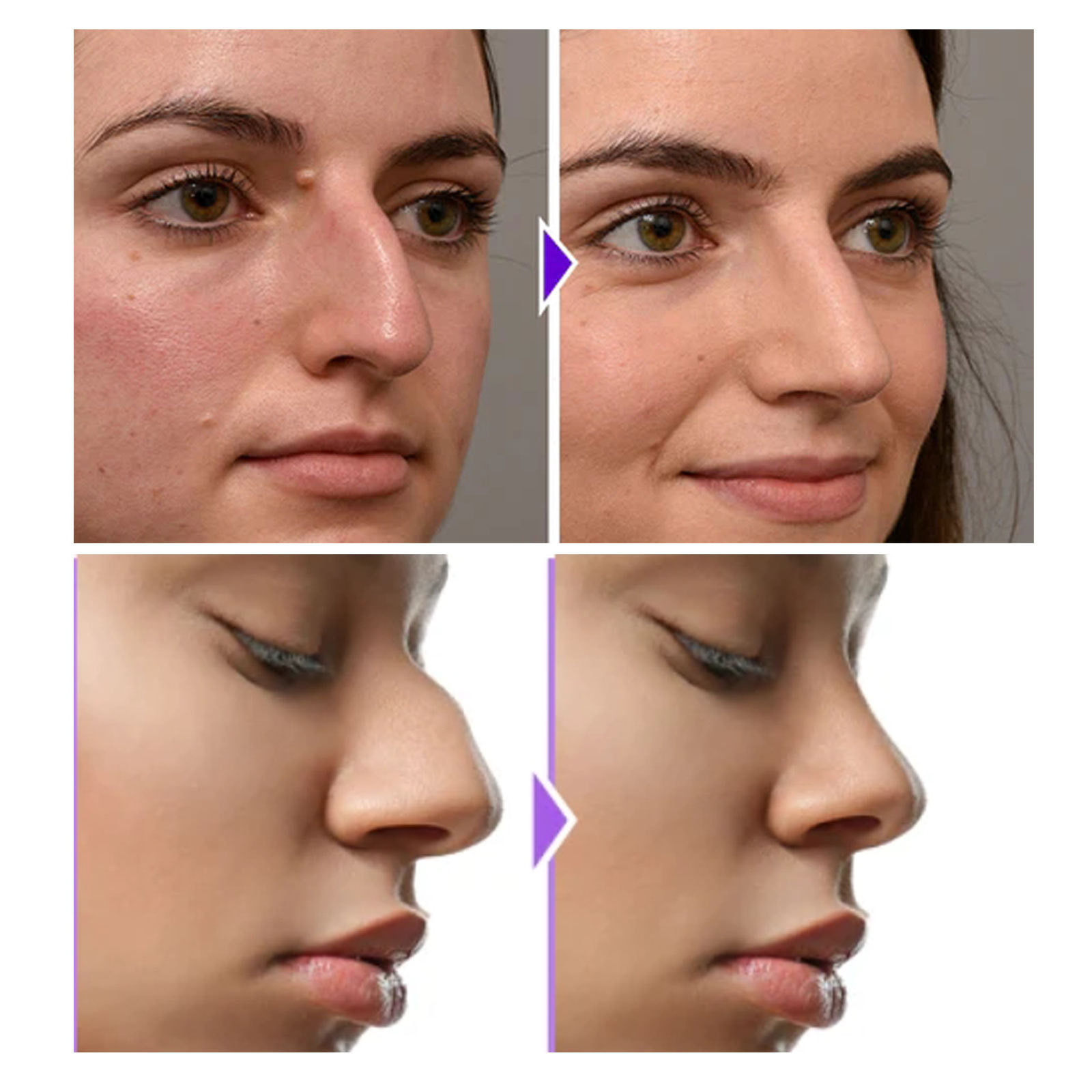 Eelhoe Nose Shaper Nose Shaping Contour Firming and Straightening Nose Bridge High Nose Bridge Beauty Nose Shaper 4