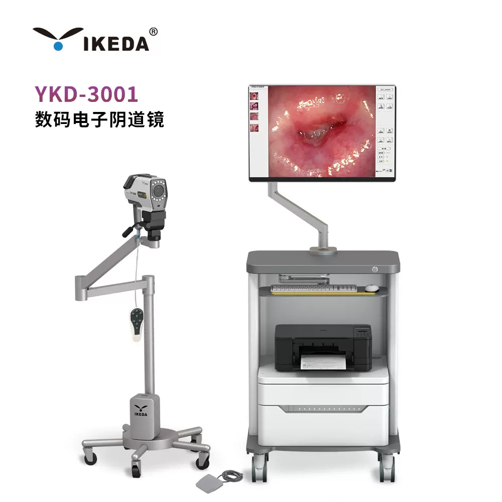 益柯达数码电子阴道镜  妇科阴道、宫颈、外阴部位病变的检查设备