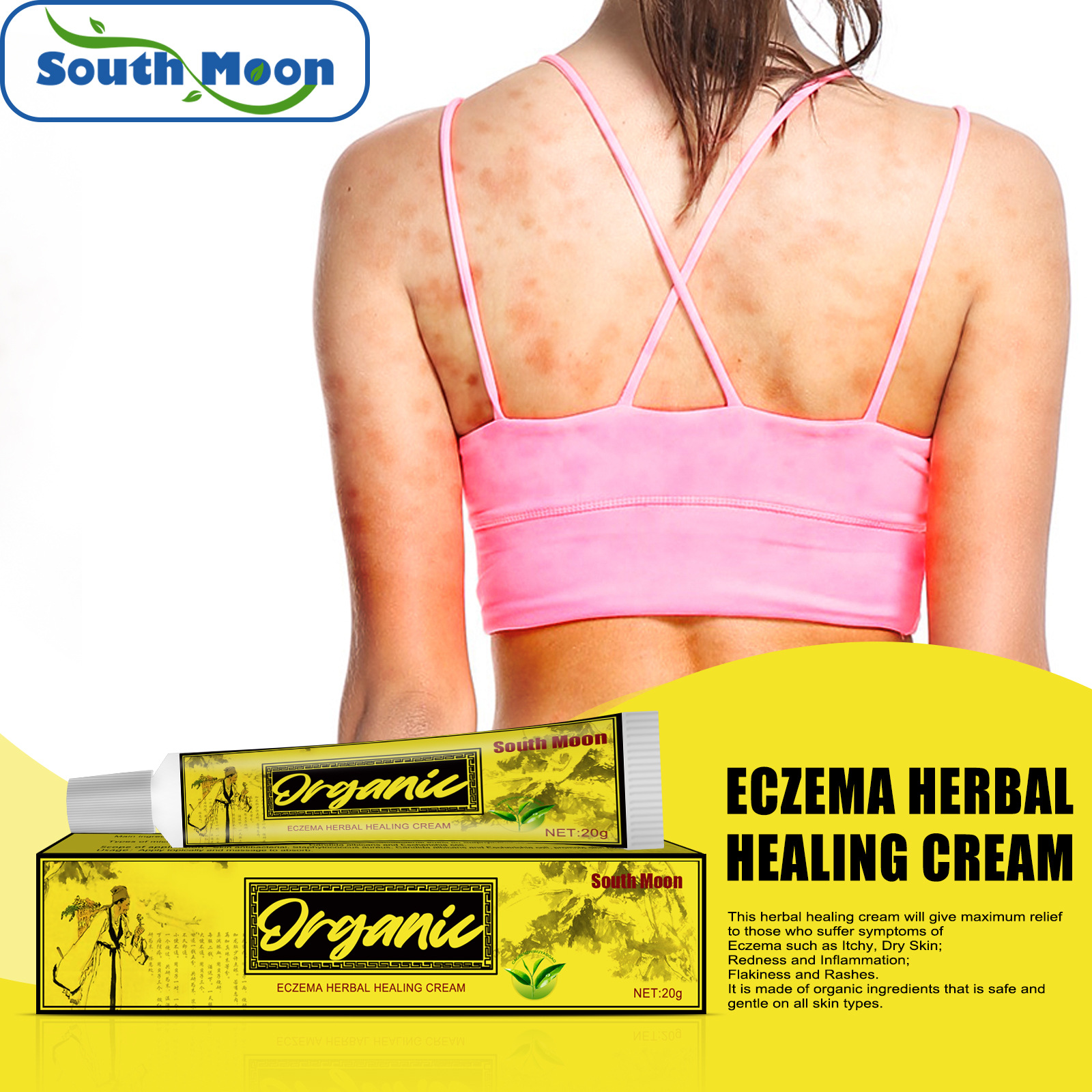 South Moon Wet Scabies Herbal Healing Cr...