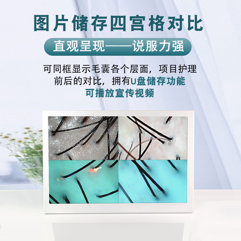 Instrumento de detección de cuero cabelludo pérdida de cabello folículo 3 espectro HD analizador peluquería salón de belleza instrumento de prueba de la piel