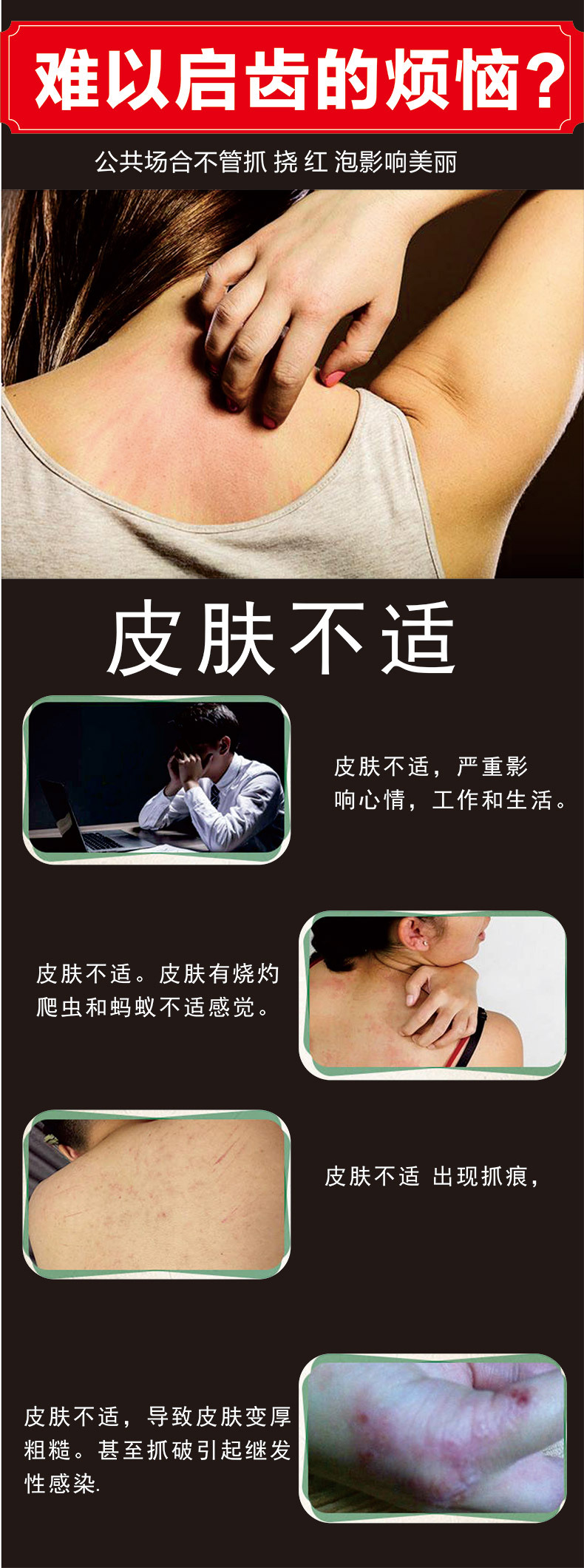 Zhiyang Ling Soothing Skin Cream 20g External Herbal Ointment for Legs quality and texture