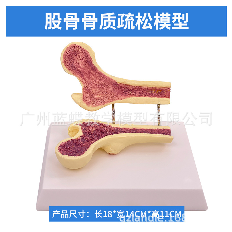 ����ɹǹ������ɽ���ģ���ȹǽ����� ��������걾 ������׵ģ��