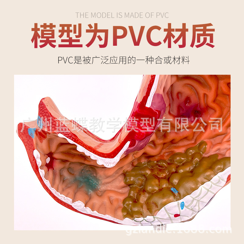 ����θģ�� ����θ�Ĵ��� ��̬θģ�� ������ θ��״������ʷŴ�