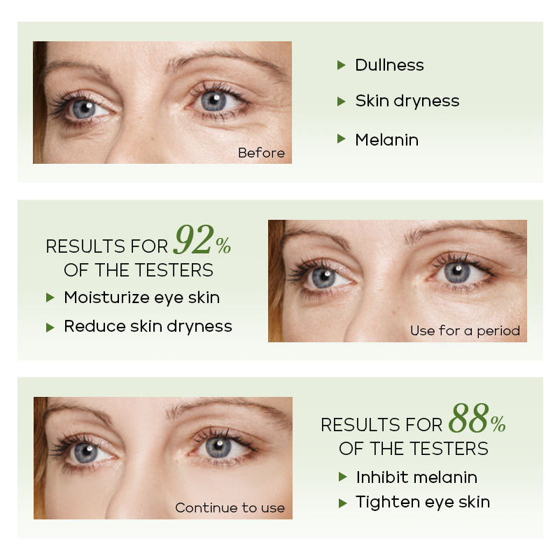 FENYI Fenyi Green Tea Eye Essence 15ml Hydrating Moisturizing Nourishing for Eye Skin Manufacturer Cross-border