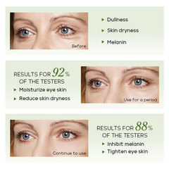 FENYI Fenyi Green Tea Eye Essence 15ml Hydrating Moisturizing Nourishing for Eye Skin Manufacturer Cross-border