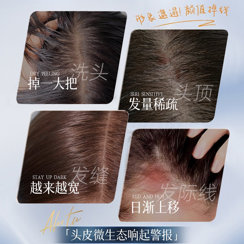 Suxiu Chen 's anti-rotura serente para mejorar la calidad del cabello seco y seco, suave, suave, fluido, control de aceite, denso, fabricante