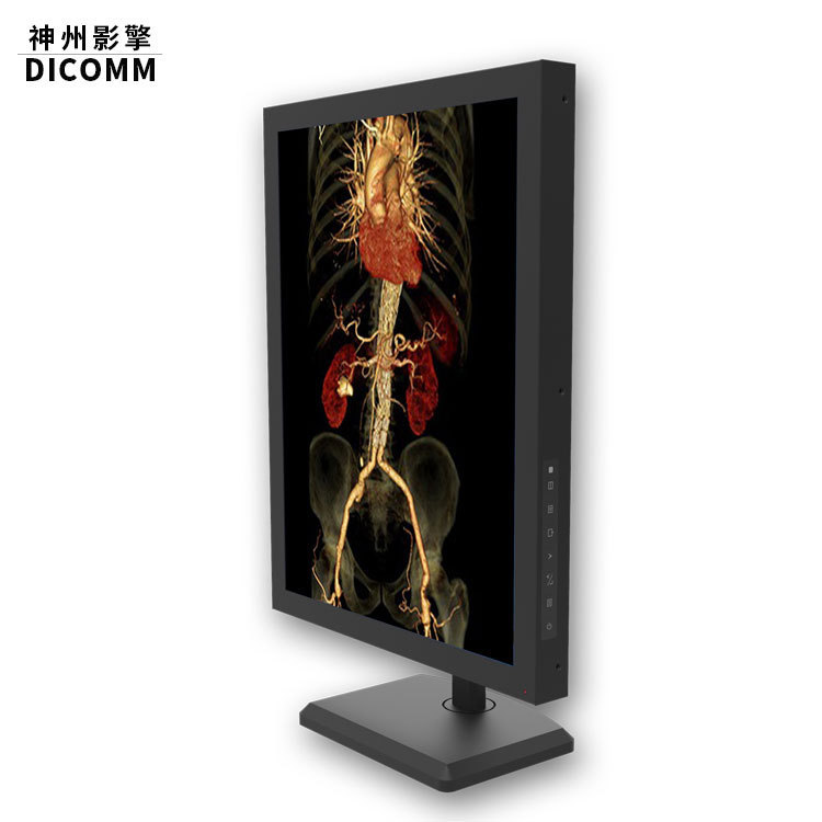 3m Color Grayscale X-Ray Vertical Screen Medical Display, Radiological Diagnostic Display, Hospital 3-Megapixel Consultation Display