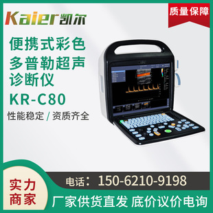 Kyle B -ultrasound Ultrasounce Equipment Portable Color Ultrasounce Machine Цена Оптовая B -ultrasound Machine Color B -uultrasound Equipment