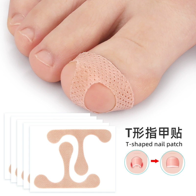 Т-образная наклейка для ногтей канавка внутренний рулон эластичный стрейч без клея Подушечка Для ногтей ремонт ногтей ортопедический патч