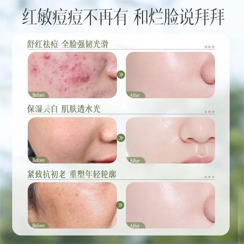 积雪草熬夜水乳套装舒缓修复补水保湿提亮控油精华乳液正品批发女|undefined