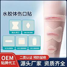 医用水胶体伤口贴防水人工皮湿性愈合擦烫伤点痣痘痘贴水胶体敷料