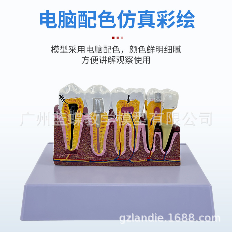 ���ƿ�ǻ�ı�ȣ�ݷֽ�ģ�� ����������ʾȣ�ݷ�չ���� ҽ����ͨ