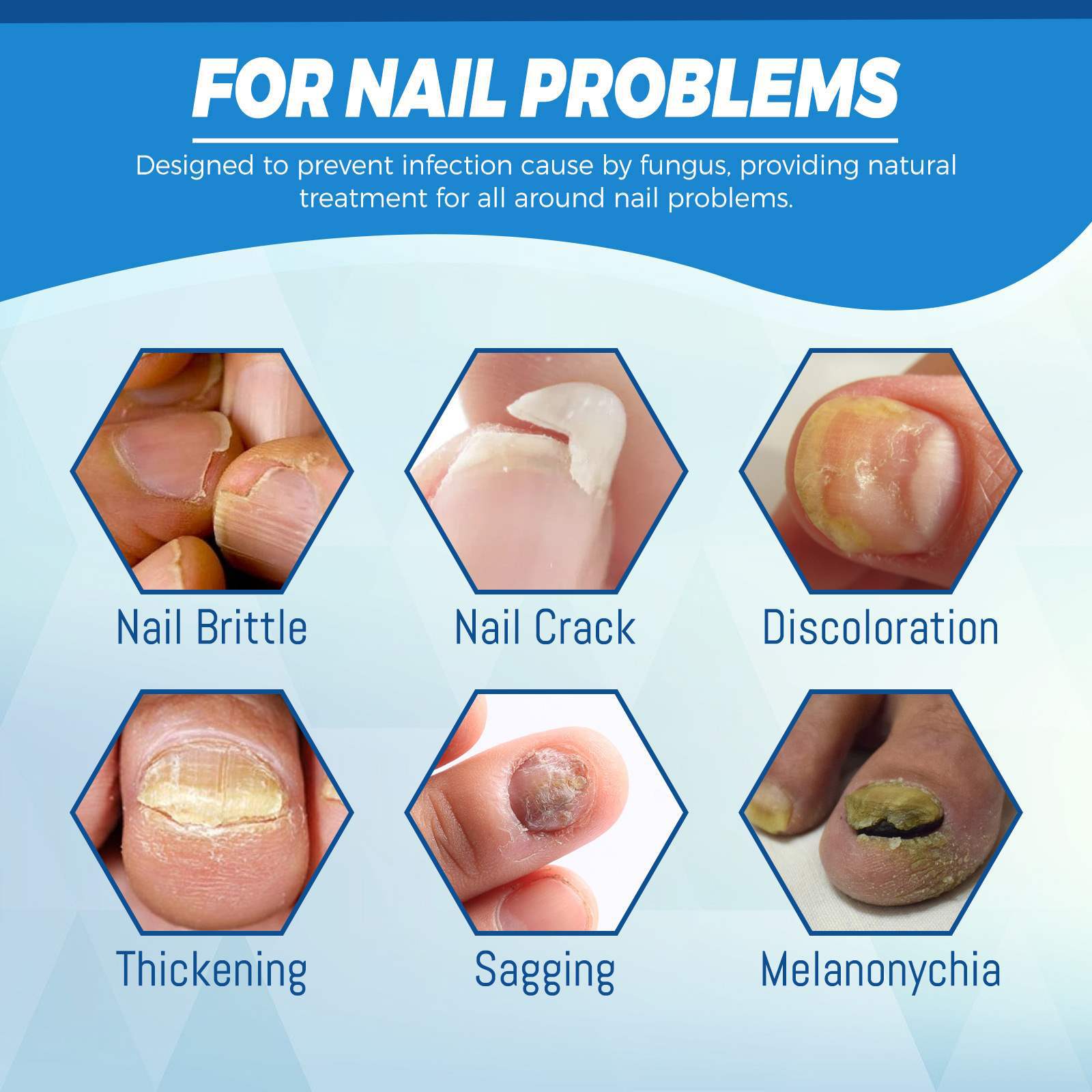 Lézer toll szokásos specifikációkkal és opcionális akkumulátorvásárlással