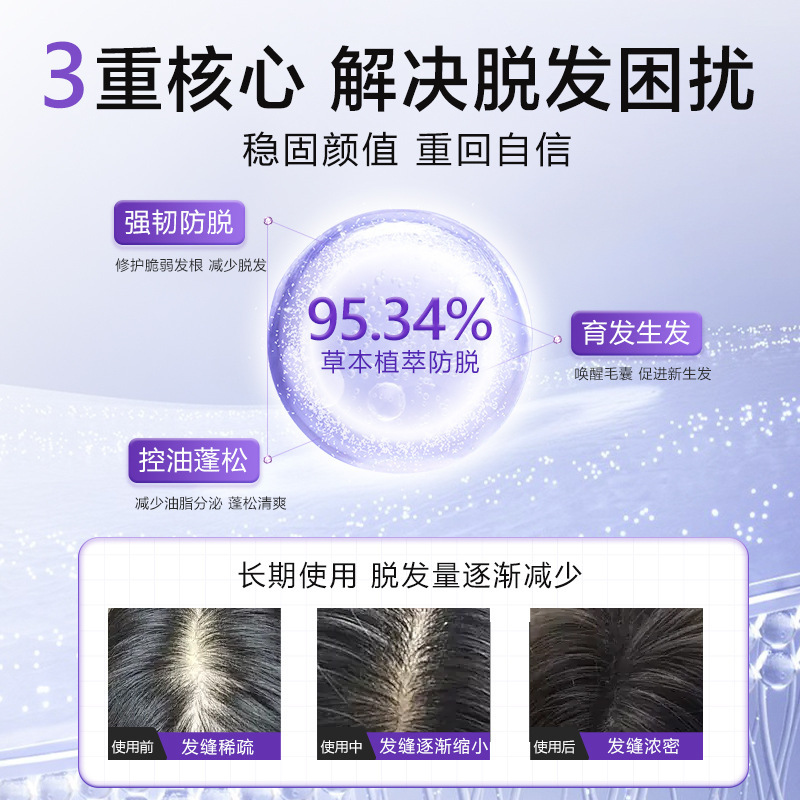 WOLMEST韓国美女鑫防脱シャンプー500ml防脱髪固発育髪純正品コントロール油がふんわりしている|undefined