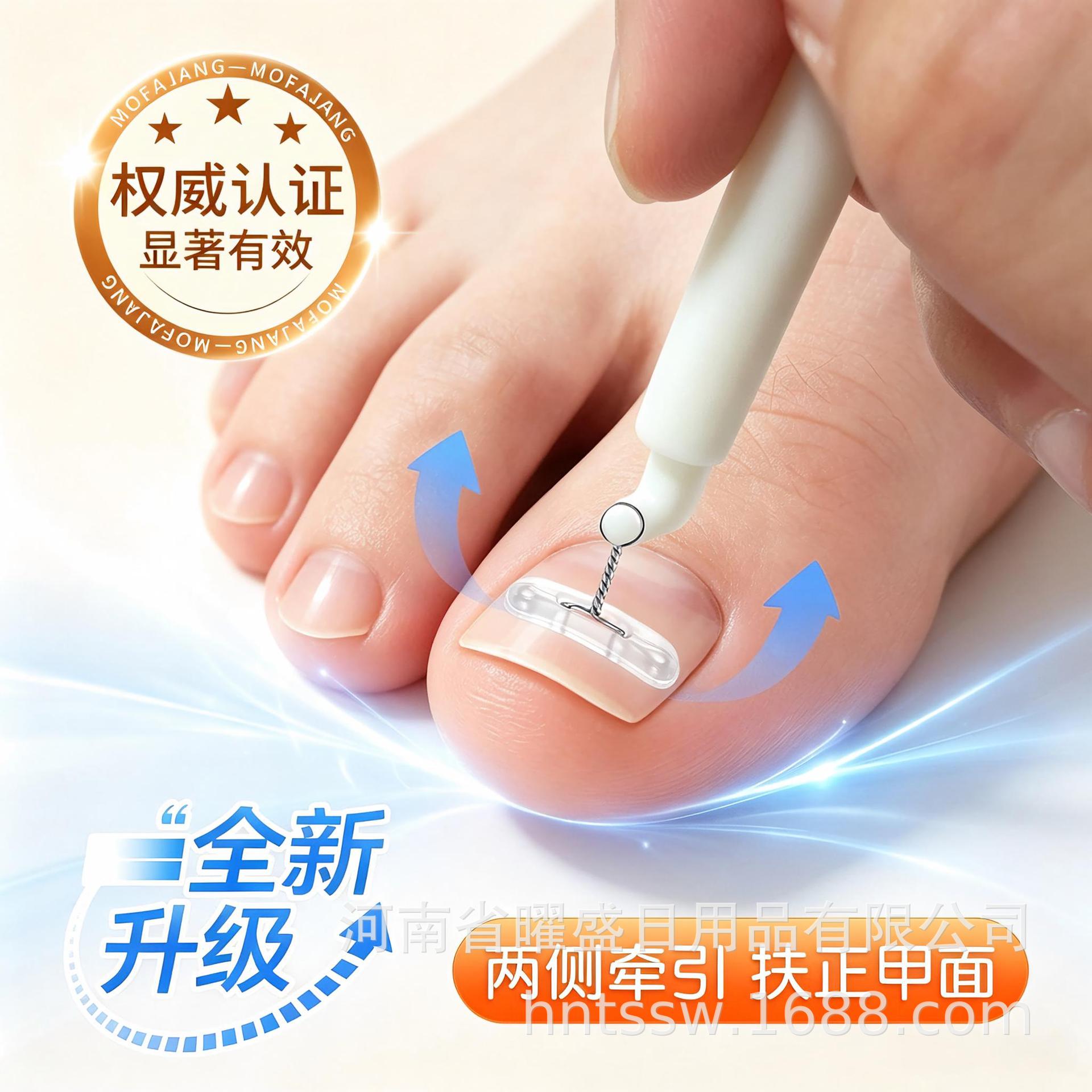 Ingrown toenail correction device with small U-shape shield, TPE stainless steel biomimetic bone patch, toe nail patch, and nail inflammation corrector