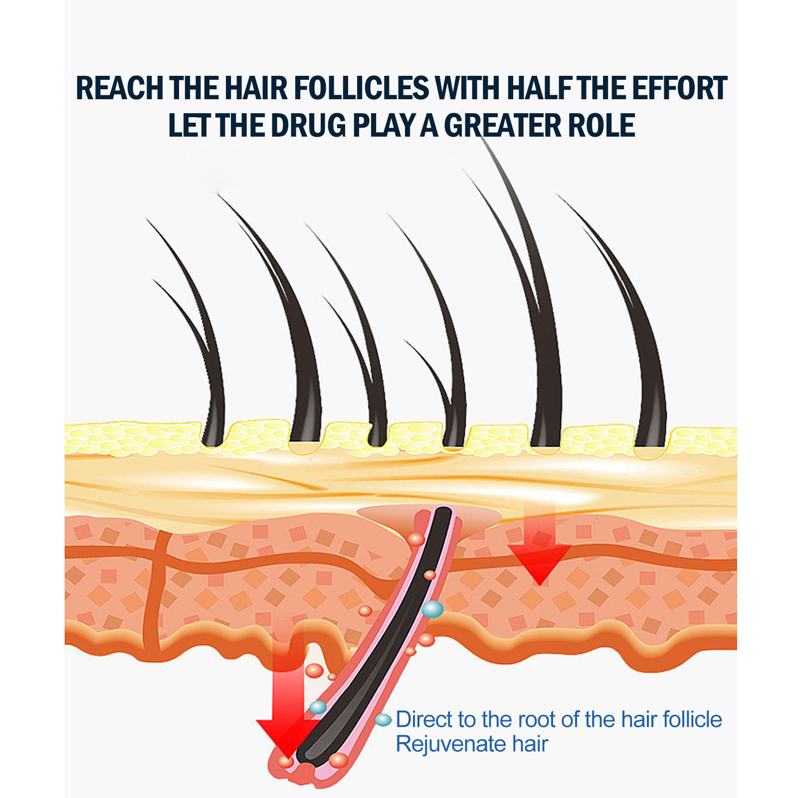 Fortschrittliches Haaransatz-Wachstumsspray für Männer – Fördert dickeres und kräftigeres Haarwachstum; Anti-Haarausfall-Formel für feste Haarpflege_voghion.com